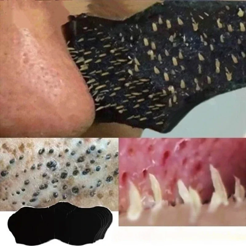 Unisex Blackhead Remove Mask N - Skincare Finally Found You review and price