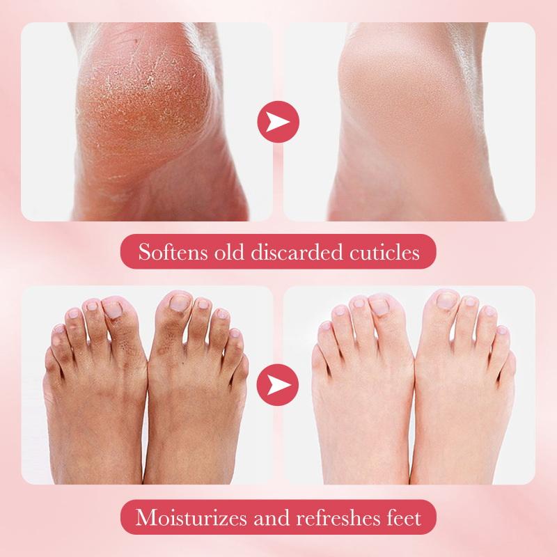 1 Pairs SADOER Fruits Foot Mas - Skincare Finally Found You review and price